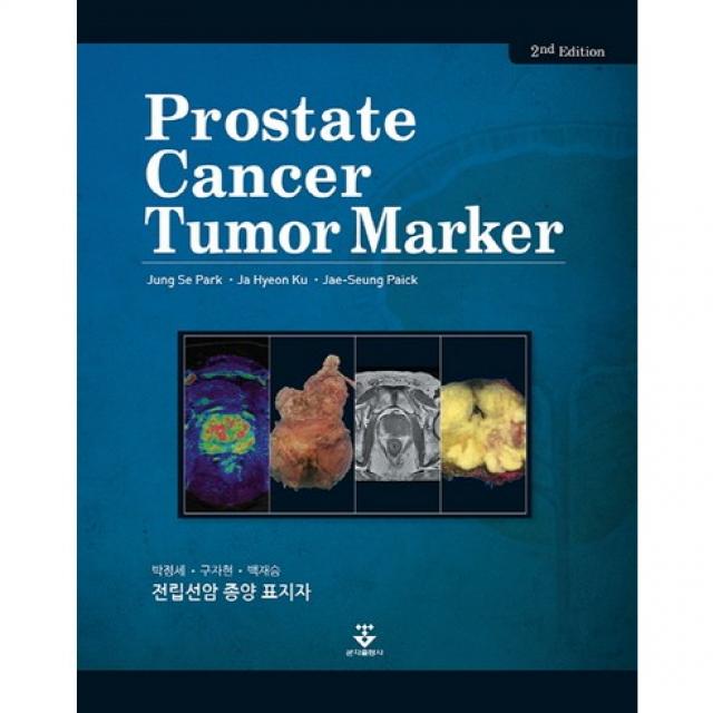 [군자출판사]전립선암 종양 표지자(Prostate Cancer Tumor Marker)_박정세_2016 제2판, 군자출판사