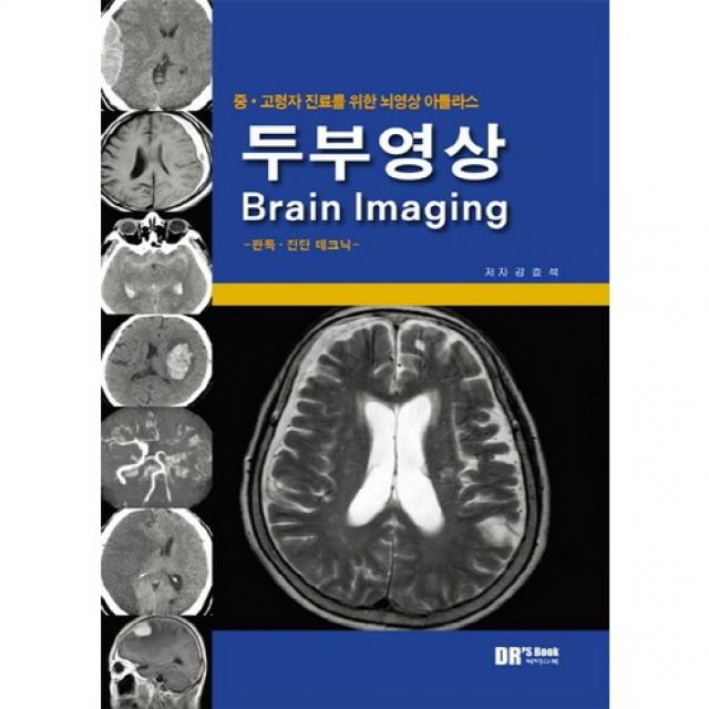  닥터스북 중 고령자 진료를 위한 뇌영상 아틀라스 두부영상 Brain Imaging :판독 진단 테크닉_강효석_2012 닥터스북