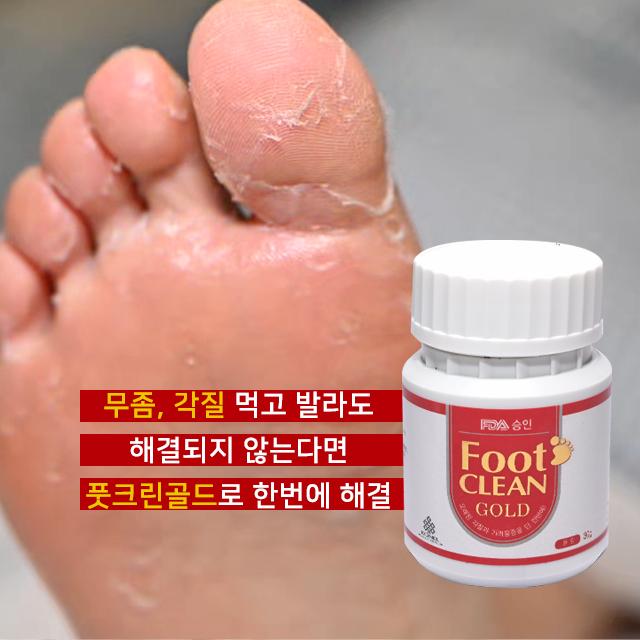 발냄새제거제 풋케어 곰팡이 발가락 냄새 발바닥 무좀 발톱 습진 각질 가려움 다한증 세균, 파우더 형태 30g