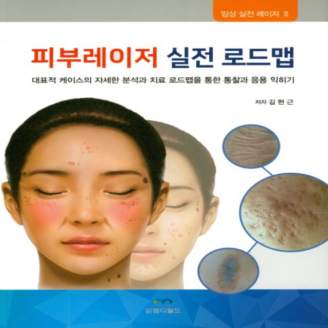 피부레이저 실전 로드맵:대표적 케이스의 자세한 분석과 치료 로드맵을 통한 통찰과 응용 익히기, 엠디월드, 김현근