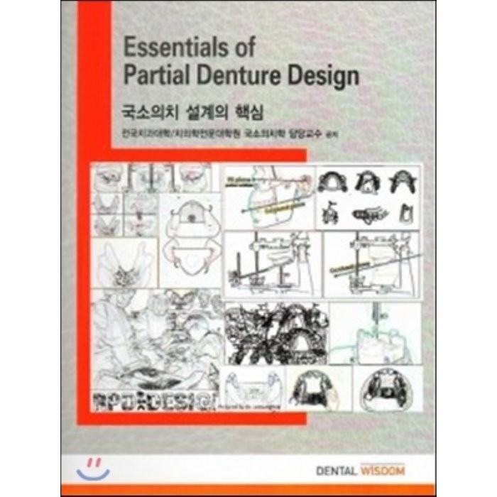 Essentials of Partial Denture Design : 국소의치 설계의 핵심, DENTAL WISDOM