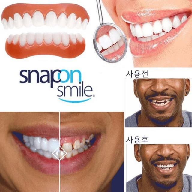 Snapon Smile 구강 전용 실리콘 임시틀니 4세대 미백틀니 윗니+아랫니 인공치아틀니, 윗니용