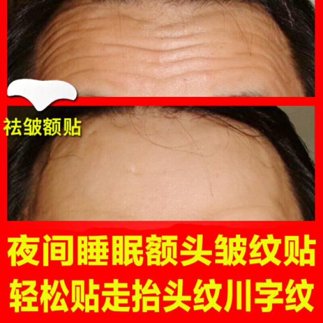[녹음동량중기의 주름을 없애고 남자 이마의 주름을 없애는 문양[신기녀] 수면과 밤에 쭈글 남사주름의 주름살을 없애다.(9289), 1개, 0ml