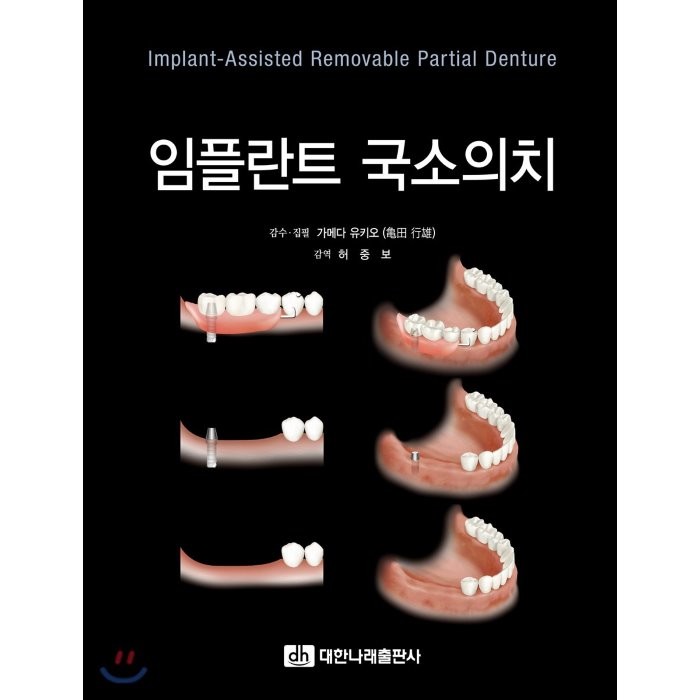 임플란트 국소의치, 대한나래출판사