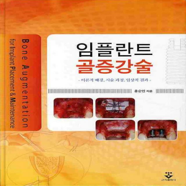 임플란트 골증강술:이론적 배경 시술 과정 임상적 결과, 군자출판사