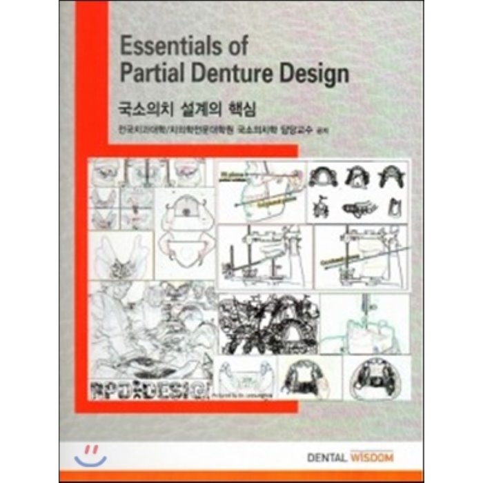 Essentials of Partial Denture Design : 국소의치 설계의 핵심, DENTAL WISDOM
