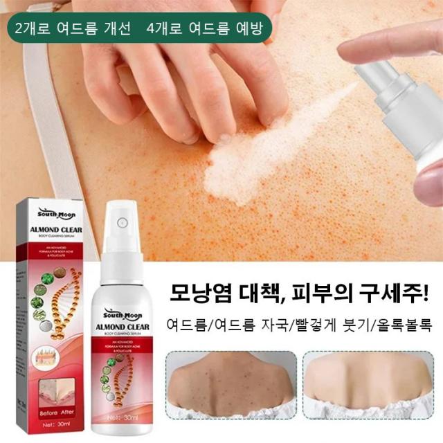 (1+1) 피부건선 모낭염 연고 가려움증 지루성피부염 스프레이 30ml *2, 대책 등판 미녀 스프레이(30ml)*2