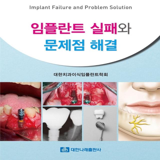 임플란트 실패와 문제점 해결, 대한나래출판사