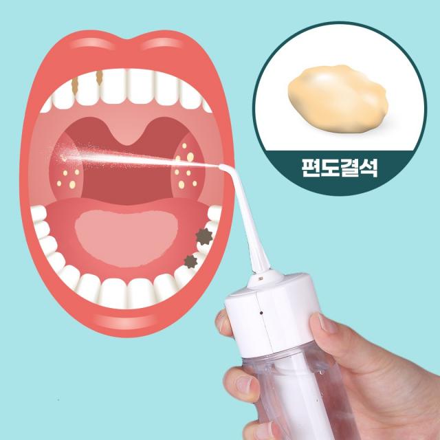 핀처 클리어픽 편도결석 제거기 입냄새 구취 편도석 흡입기, 1개