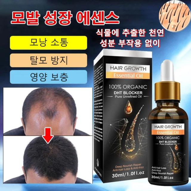 모발 성장 에센스 30ml 식물에 추출한 천연 성분 부작용 없이 안정적이다 머리카락이 많고 촘촘하게 변함