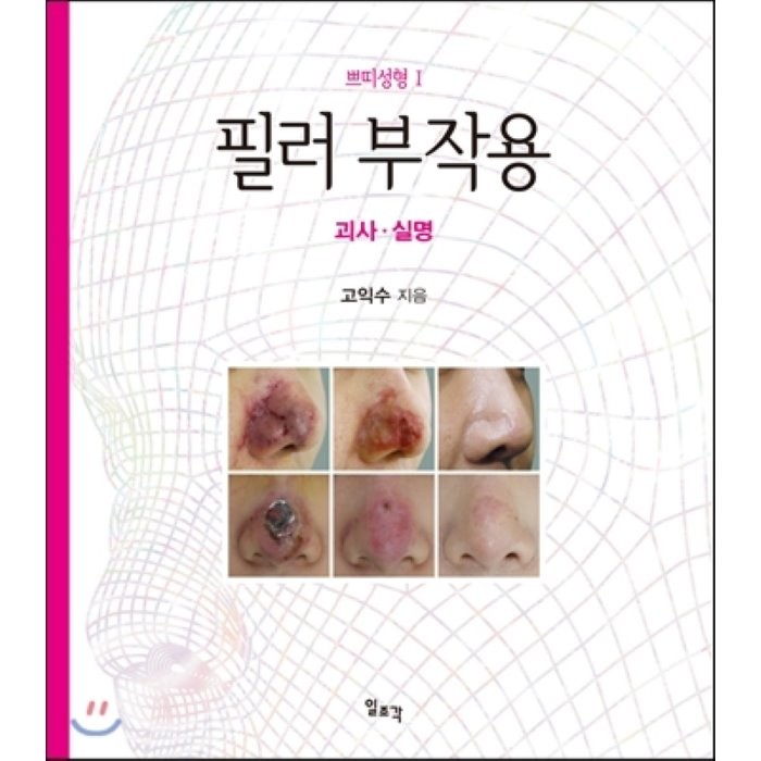 [일조각]필러 부작용: 괴사 실명(쁘띠성형 1)(양장본 HardCover), 일조각